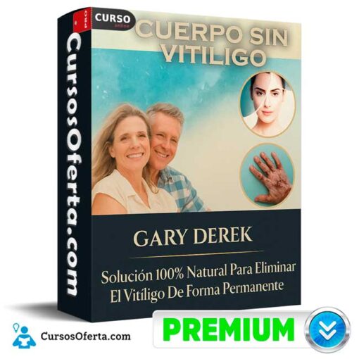 Cuerpo sin vitiligo de Gary Derek cuerpo sin vitiligo de gary derek 694e3fb44667e